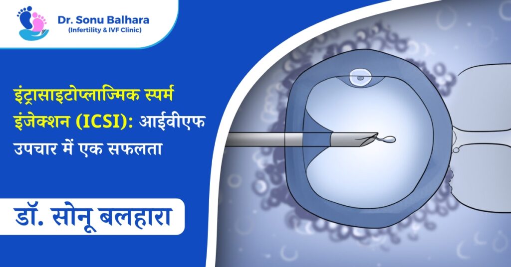 इंट्रासाइटोप्लाज्मिक स्पर्म इंजेक्शन (ICSI): आईवीएफ उपचार में एक सफलता