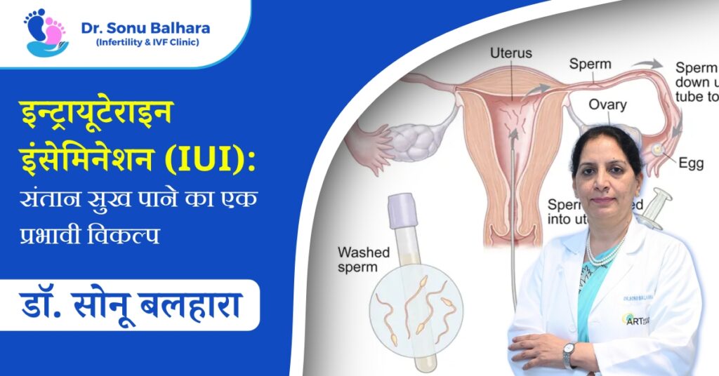 इन्ट्रायूटेराइन इंसेमिनेशन (IUI) संतान सुख पाने का एक प्रभावी विकल्प