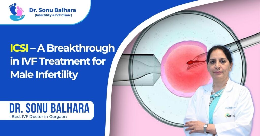 ICSI – A Breakthrough in IVF Treatment for Male Infertility