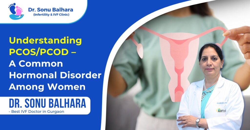 Understanding PCOSPCOD – A Common Hormonal Disorder Among Women