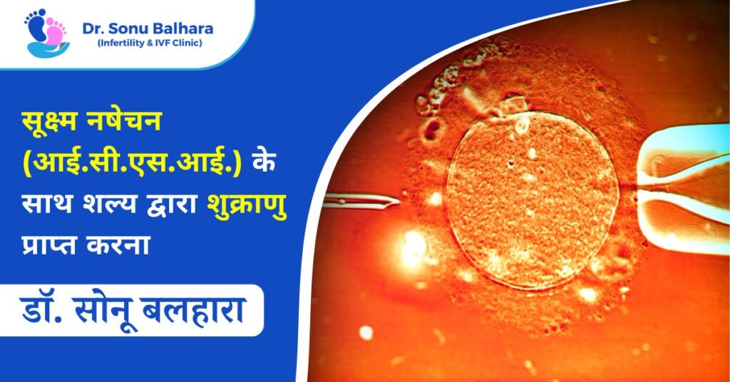 सूक्ष्म नषेचन (आई.सी.एस.आई.) के साथ शल्य द्वारा शुक्राणु प्राप्त करना